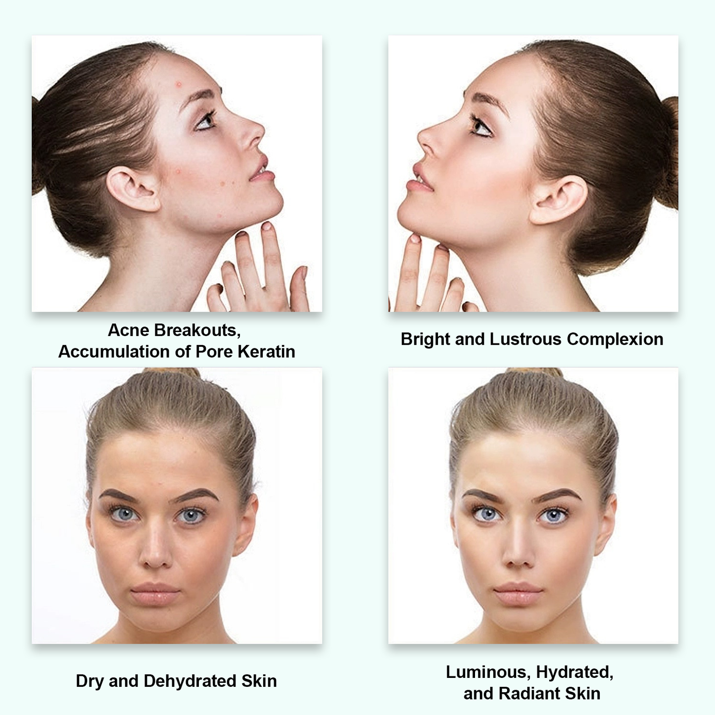 Dr. Pen Ultima M5 Wireless Microneedling Pen