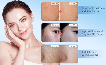 Dr. Pen M8S Microneedling Pen with 30PCS Cartridges