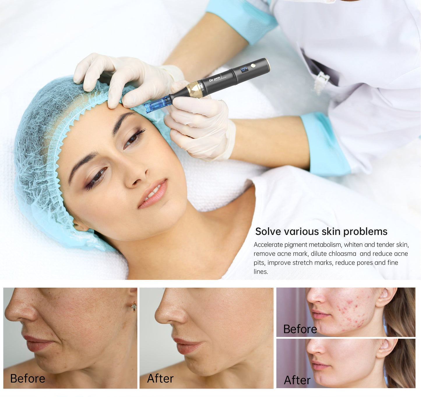 Dr. Pen A8S Ultima Pro Microneedling Pen  With 10pcs Cartridges